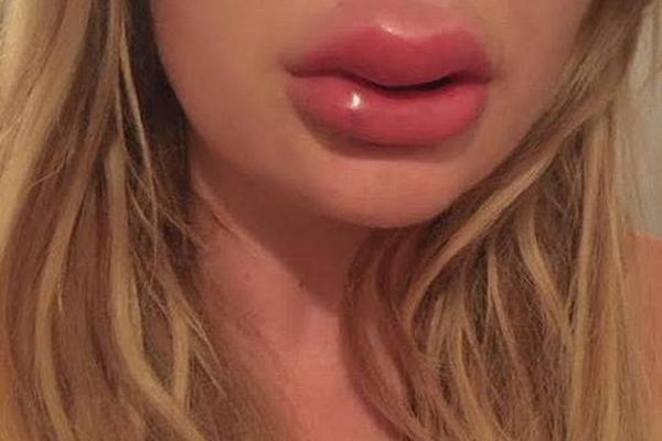 初生的东曦，击碎黑暗！